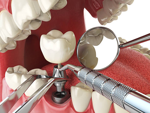 Best Emergency Tooth Extraction  in Fairmont, IL
